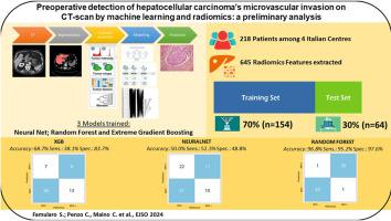 Preoperative detection of hepatocellular carcinoma's microvascular invasion on CT-scan by machine learning and radiomics: A preliminary analysis.