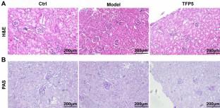 Whole transcriptome mapping reveals the lncRNA regulatory network of TFP5 treatment in diabetic nephropathy.