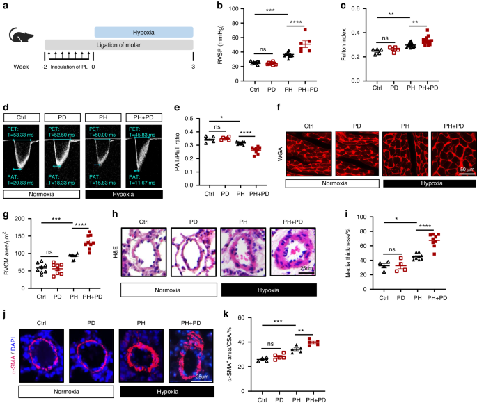 Periodontitis exacerbates pulmonary hypertension by promoting IFNγ+ T cell infiltration in mice