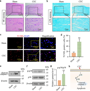 Compensatory upregulation of MT2A alleviates neurogenic intermittent claudication through inhibiting activated p38 MAPK-mediated neuronal apoptosis