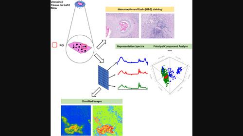 Suitability of Fourier transform infrared microscopy for the diagnosis of cystic echinococcosis in human tissue sections