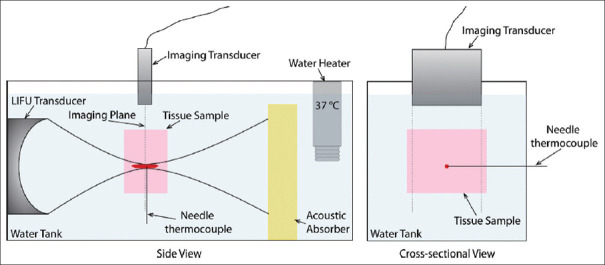 Noninvasive Monitoring of Tissue Temperature Changes Induced by Focused Ultrasound Exposure using Sparse Expression of Ultrasonic Radio Frequency Echo Signals.