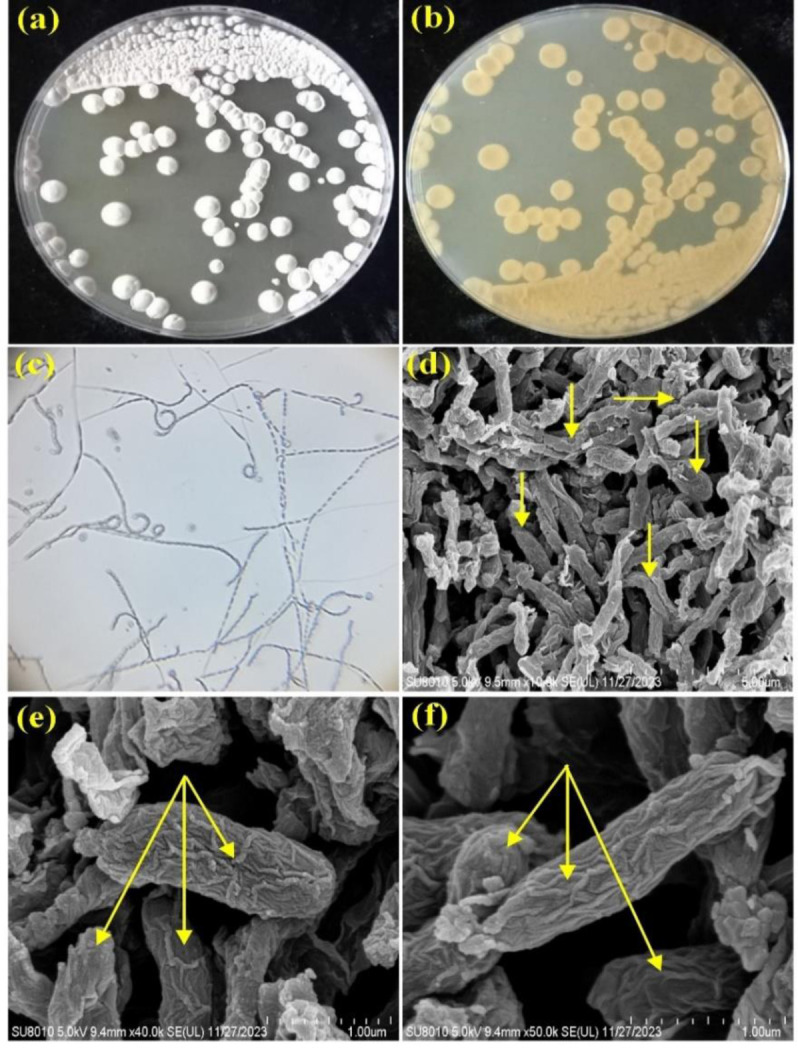 <i>Nocardiopsis synnemataformans</i> NBRM9, an extremophilic actinomycete producing extremozyme cellulase, using lignocellulosic agro-wastes and its biotechnological applications.