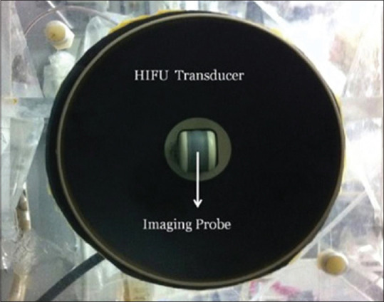 Noninvasive Monitoring of Tissue Temperature Changes Induced by Focused Ultrasound Exposure using Sparse Expression of Ultrasonic Radio Frequency Echo Signals.