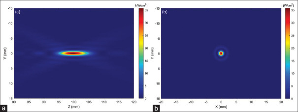 Noninvasive Monitoring of Tissue Temperature Changes Induced by Focused Ultrasound Exposure using Sparse Expression of Ultrasonic Radio Frequency Echo Signals.