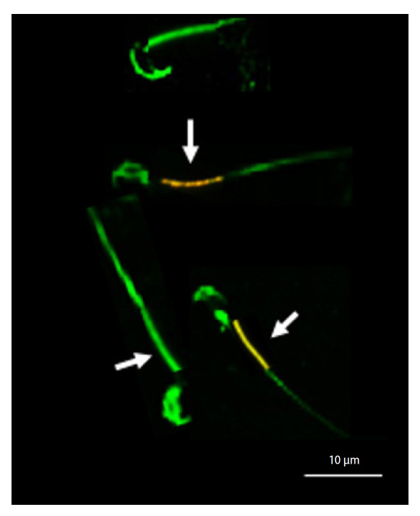 The protective effect of zinc oxide and selenium oxide nanoparticles on the functional parameters of rat sperm during vitrification.