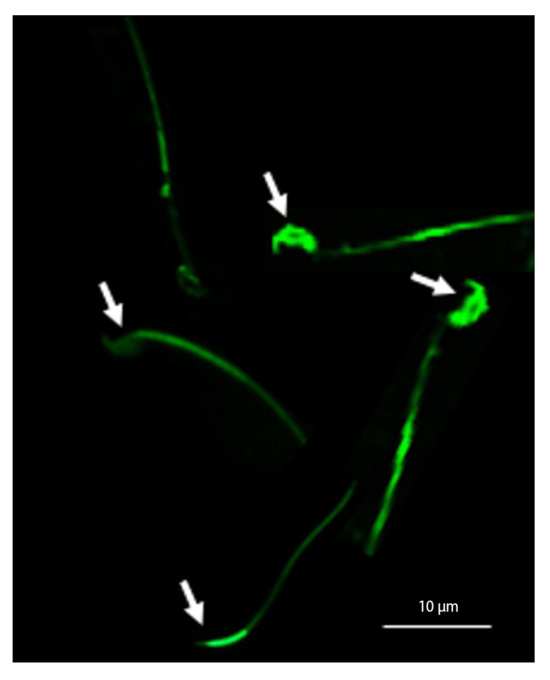 The protective effect of zinc oxide and selenium oxide nanoparticles on the functional parameters of rat sperm during vitrification.