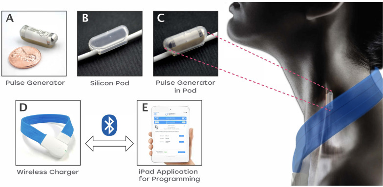 Clinical safety and feasibility of a novel implantable neuroimmune modulation device for the treatment of rheumatoid arthritis: initial results from the randomized, double-blind, sham-controlled RESET-RA study.
