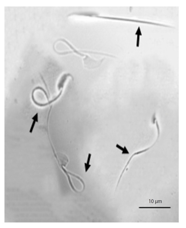 The protective effect of zinc oxide and selenium oxide nanoparticles on the functional parameters of rat sperm during vitrification.