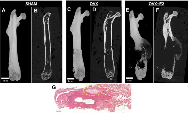 Estradiol induces bone osteolysis in triple-negative breast cancer via its membrane-associated receptor ERα36.