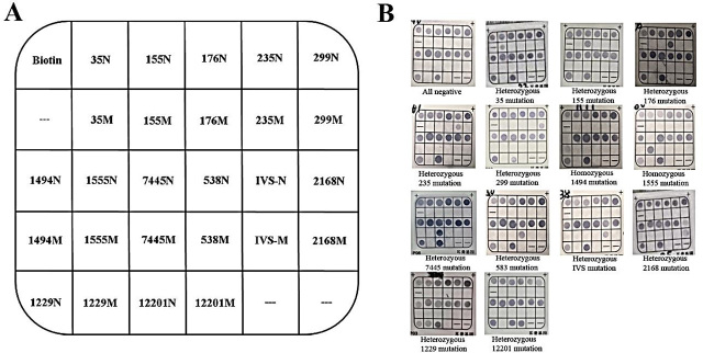 Establishment and application of a reverse dot blot assay for 13 mutations of hearing-loss genes in primary hospitals in China.