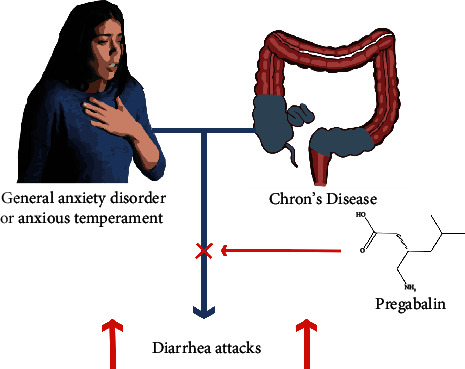 Low Dose Pregabalin Improves Gastrointestinal Symptoms of Crohn's Disease.
