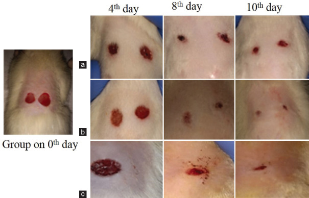 Wound-healing effect of topical nanoemulsion-loaded cream and gel formulations of Hippophae rhamnoides L. (sea buckthorn) fruit oil and their acute dermal toxicity study on female SD rats.