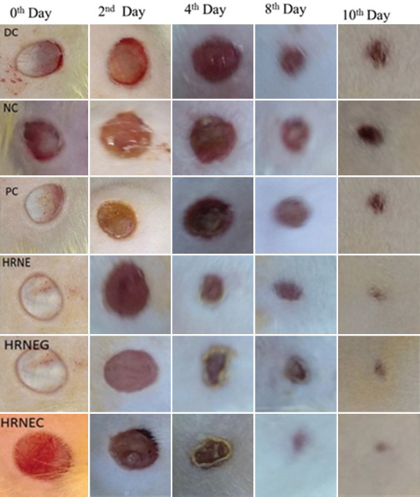 Wound-healing effect of topical nanoemulsion-loaded cream and gel formulations of Hippophae rhamnoides L. (sea buckthorn) fruit oil and their acute dermal toxicity study on female SD rats.