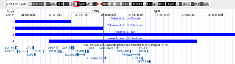 11p13 microduplication: a differential diagnosis of Silver-Russell syndrome?