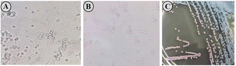 Molecular characterization of non-<i>Cryptococcus</i> yeast communities isolated from <i>Eucalyptus</i> trees.