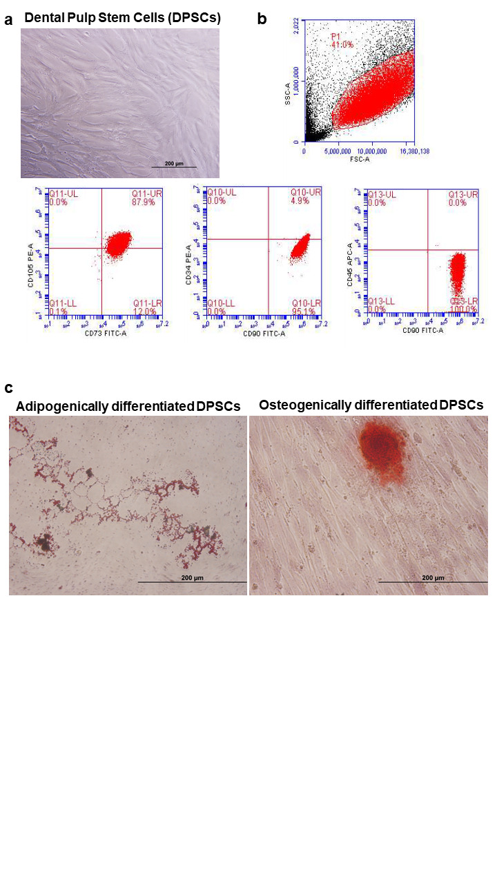 The Effects of Grape Seed Oligomeric Proanthocyanidin and Nisin on Dental Pulp Stem Cells.