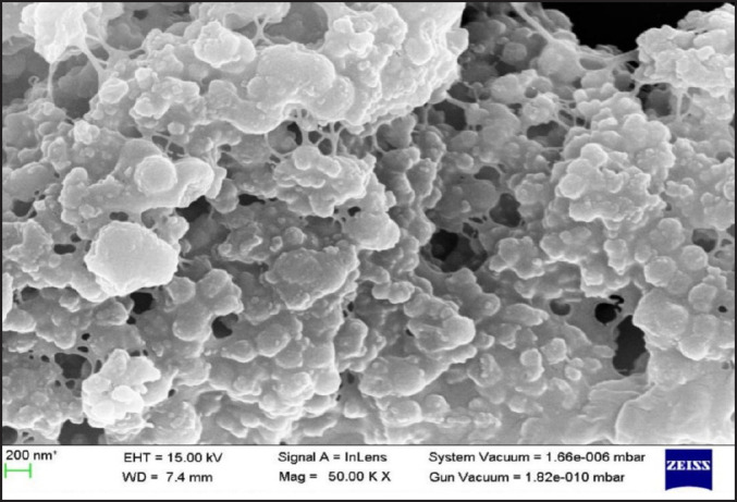 Effect of Organic and Inorganic Nanoparticles on Colour Stability and Mechanical Properties of Heat Vulcanised Maxillofacial Silicone Elastomer: a Comparative Study.