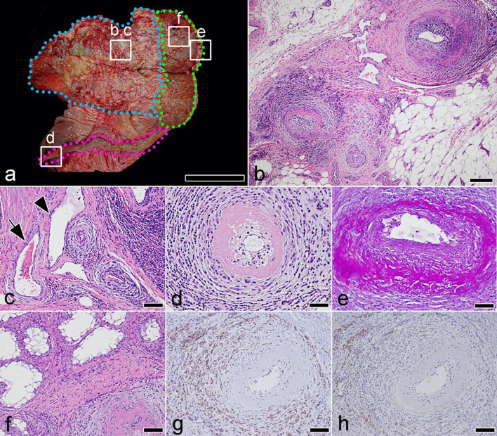 Non-suppurative and necrotizing testicular arteritis in the male reproductive organs of a heavy draft horse.