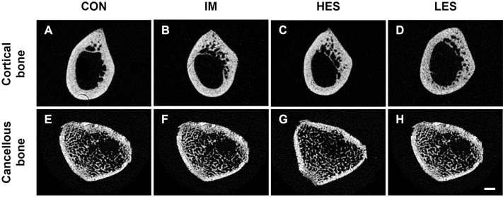 Mechanical Stress Via Muscle Contractile Exercise Suppresses Atrophic Alterations of Bone-microstructure in Immobilized Rat Femurs.