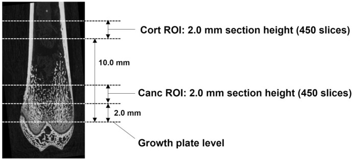 Mechanical Stress Via Muscle Contractile Exercise Suppresses Atrophic Alterations of Bone-microstructure in Immobilized Rat Femurs.