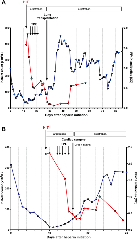 Challenges in the Monitoring of Therapeutic Plasma Exchange during Acute Heparin-Induced Thrombocytopenia in Adults under ECMO.