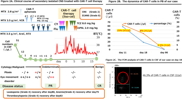 A case of successful CAR-T cell therapy for early isolated CNS recurrence of DLBCL with persistent CAR-T cells.