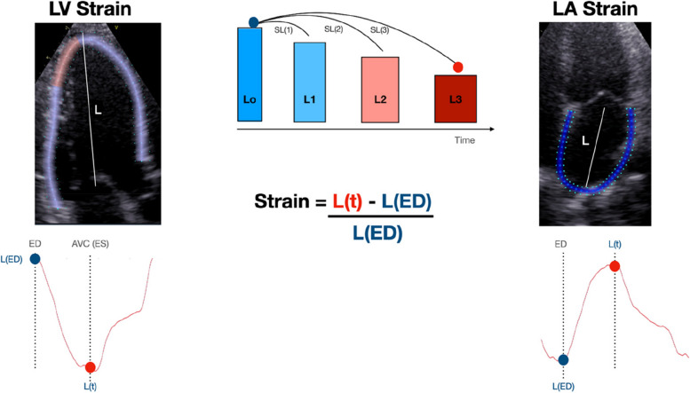 Left ventricular and atrial myocardial strain in heart failure with preserved ejection fraction: the evidence so far and prospects for phenotyping strategy.
