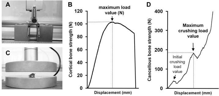 Mechanical Stress Via Muscle Contractile Exercise Suppresses Atrophic Alterations of Bone-microstructure in Immobilized Rat Femurs.