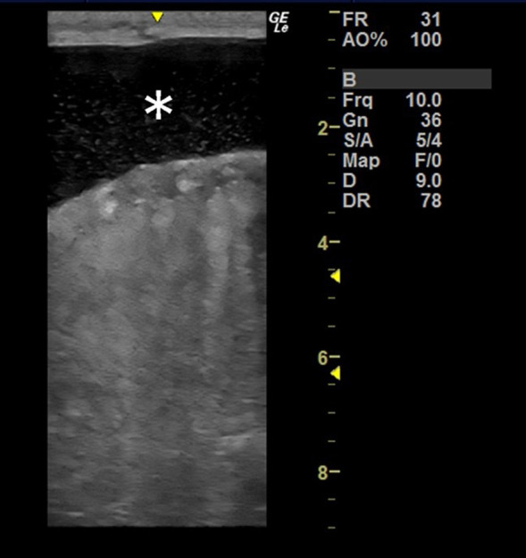Non-suppurative and necrotizing testicular arteritis in the male reproductive organs of a heavy draft horse.