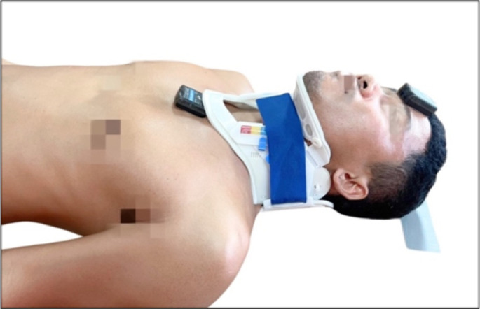 Traditional Spinal Immobilization versus Spinal Motion Restriction in Cervical Spine Movement; a Randomized Crossover Trial.