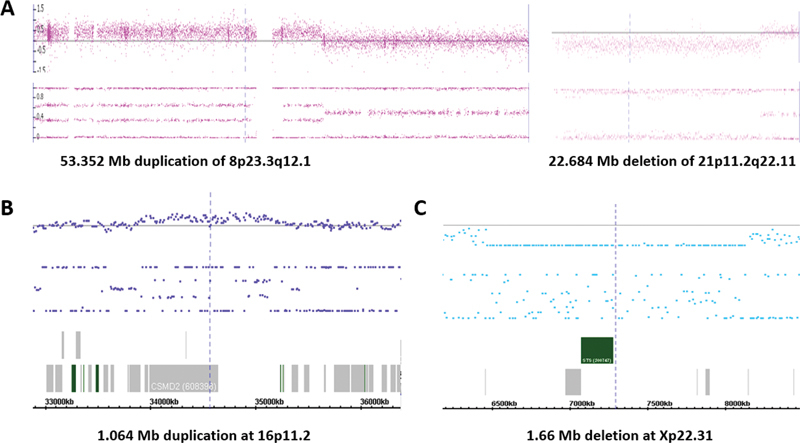 Patterns of Cytogenomic Findings from a Case Series of Recurrent Pregnancy Loss Provide Insight into the Extent of Genetic Defects Causing Miscarriages.