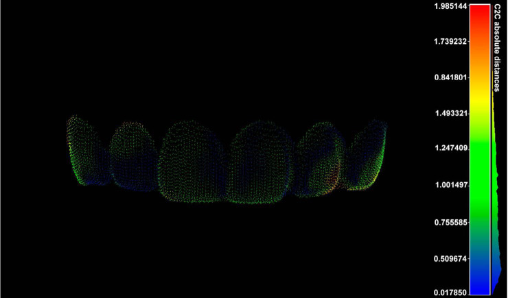 Optimization of forensic identification through 3-dimensional imaging analysis of labial tooth surface using open-source software.