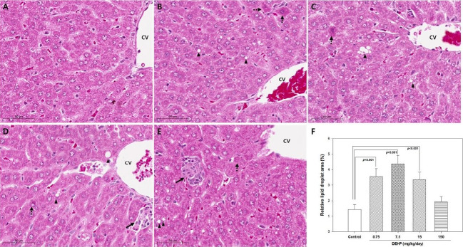 Short-term exposure to di(2-ethylhexyl)phthalate may disrupt hepatic lipid metabolism through modulating the oxidative stress in male adolescent rats.
