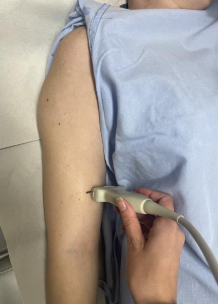 Relation Between Ultrasonographic Measurements of the Biceps Brachii and Total Muscle Mass in Older Hospitalized Persons: A Pilot Study.