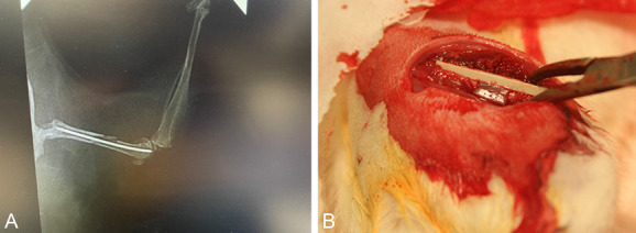 Preclinical models of orthopaedic trauma: Orthopaedic Research Society (ORS) and Orthopaedic Trauma Association (OTA) symposium 2022.