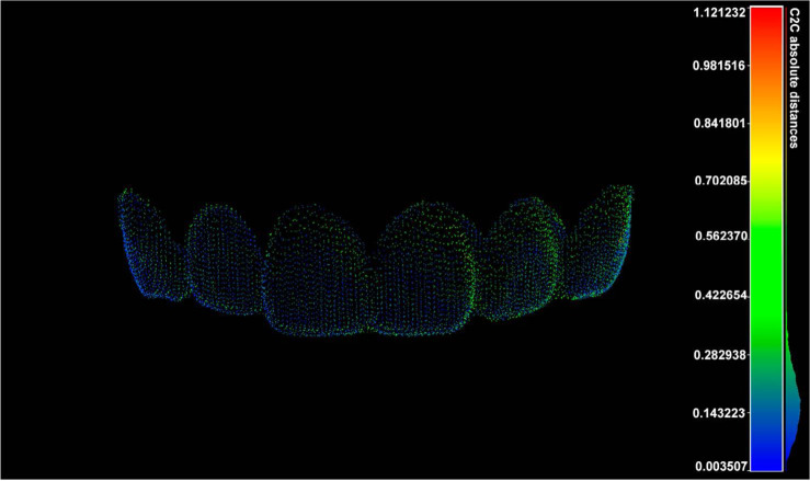 Optimization of forensic identification through 3-dimensional imaging analysis of labial tooth surface using open-source software.