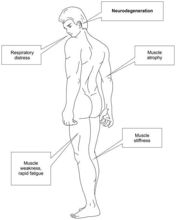A brief literature review of low-level laser therapy for treating amyotrophic lateral sclerosis and confirmation of its effectiveness.