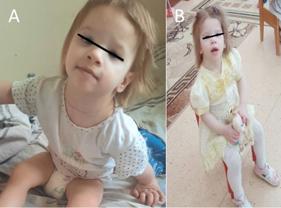 Family case of Potocki-Lupski syndrome.
