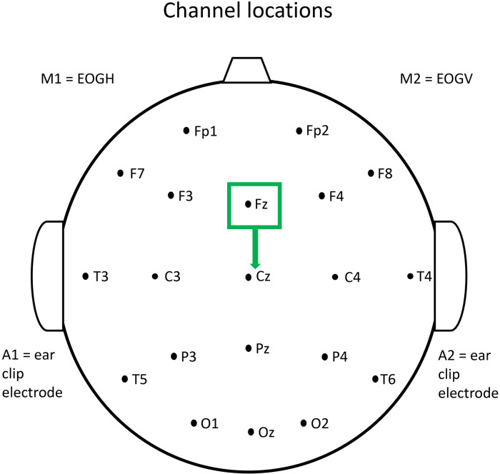 Gamma Oscillations and Potassium Channel Modulation in Schizophrenia: Targeting GABAergic Dysfunction.