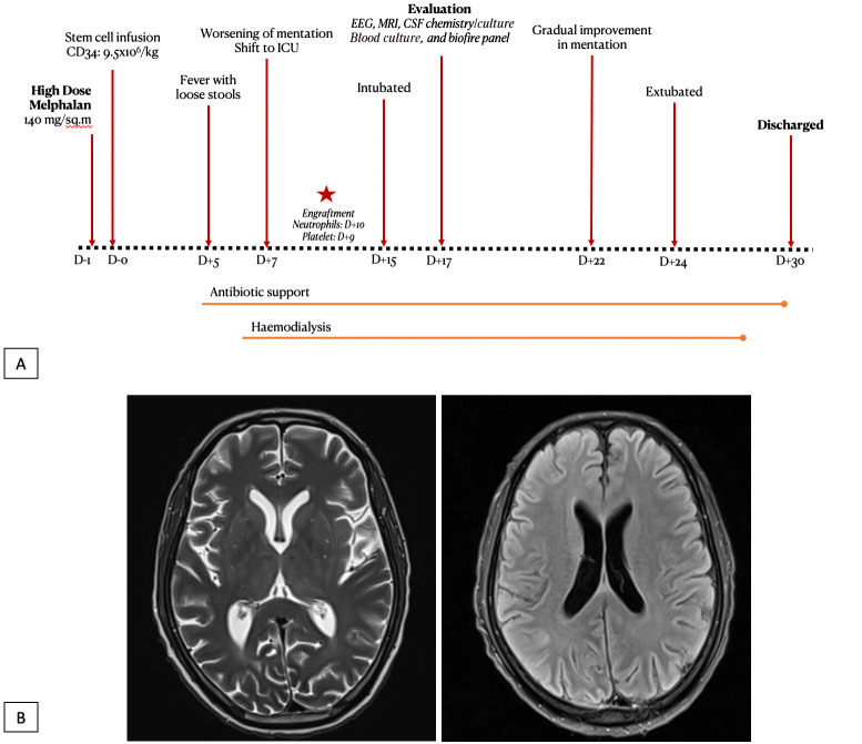 Melphalan-associated encephalopathy following autologous stem cell transplant: a transplanter's nightmare!