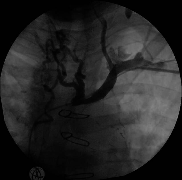 [Perioperative management for cardiovascular implantable electronic devices].