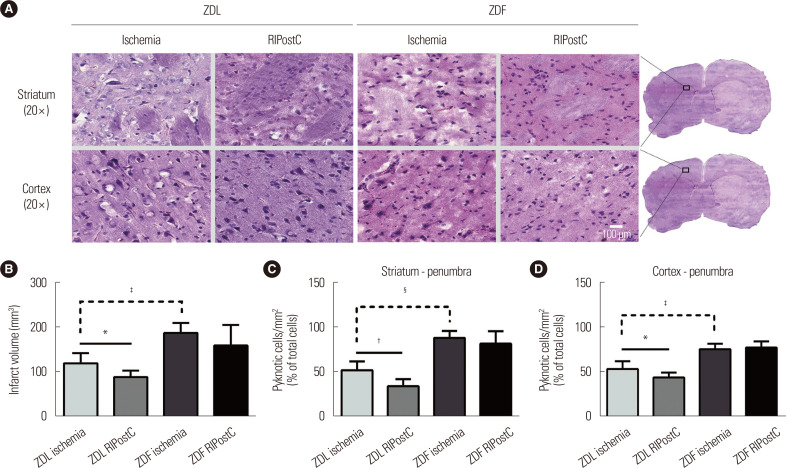 Obesity as a Limiting Factor for Remote Ischemic Postconditioning-Mediated Neuroprotection after Stroke.