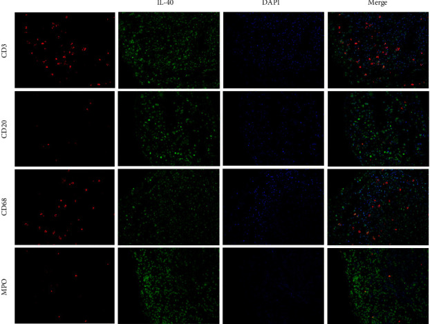 A Comprehensive Review on the Role of Interleukin-40 as a Biomarker for Diagnosing Inflammatory Diseases.