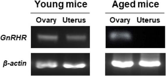 Gonadotropins Regulate the mRNA Expression of Gonadotropin-Releasing Hormone and Its Receptors in the Mouse Ovary and Uterus.
