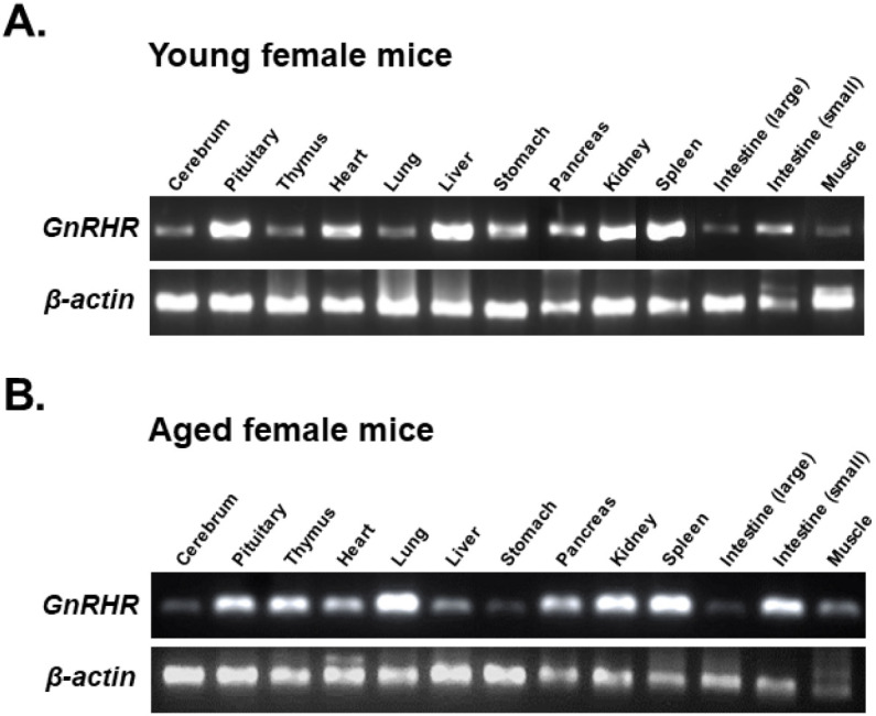 Gonadotropins Regulate the mRNA Expression of Gonadotropin-Releasing Hormone and Its Receptors in the Mouse Ovary and Uterus.