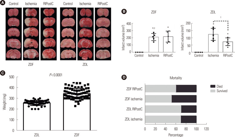 Obesity as a Limiting Factor for Remote Ischemic Postconditioning-Mediated Neuroprotection after Stroke.