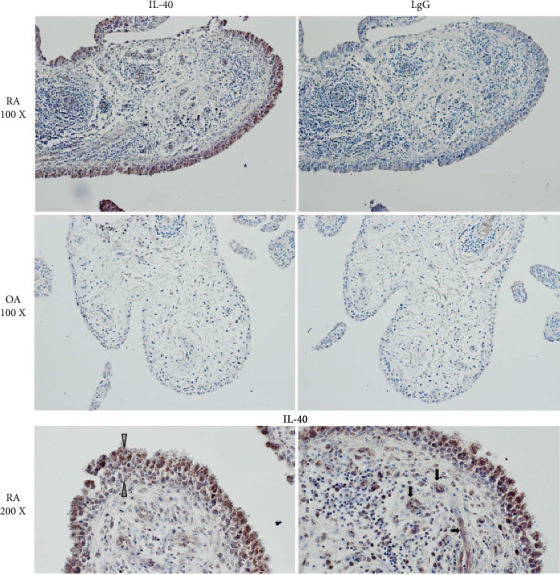 A Comprehensive Review on the Role of Interleukin-40 as a Biomarker for Diagnosing Inflammatory Diseases.