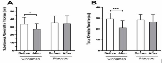 Metabolic and endocrine changes induced by cinnamon in women with polycystic ovarian syndrome: A pilot study.