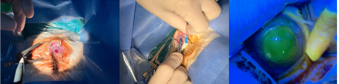 Clinically correlated dose of the amniotic membrane extract is superior to its transplantation in corneal wound healing.